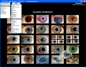 Augendiagnose Lernprogramm